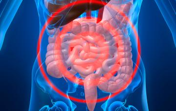 Síndrome de Lynch Síndrome de Lynch