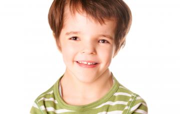 Niño con síndrome de Noonan