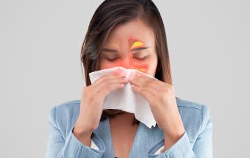 Sinusitis Qué es la sinusitis