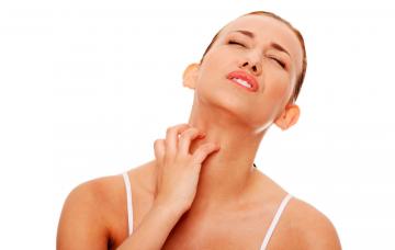 Urticaria Mujer con urticaria en el cuello
