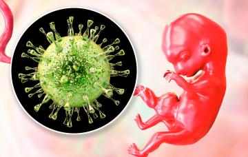 Causas de la infección por citomegalovirus