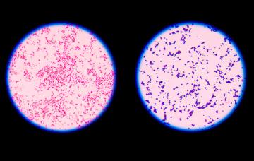 Diagnóstico de la vaginosis bacteriana