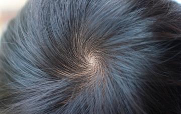 Remolinos en el pelo, por qué salen y como peinarlos Remolinos en el pelo