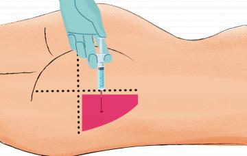 Cómo poner una inyección intramuscular