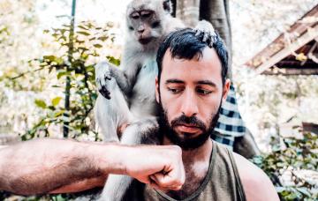 Hombre siendo contagiado por la viruela del mono