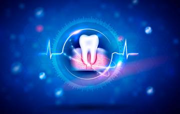 Infografía de un diente con la raíz y la encía inflamadas