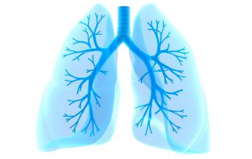 Qué es el cáncer de pulmón