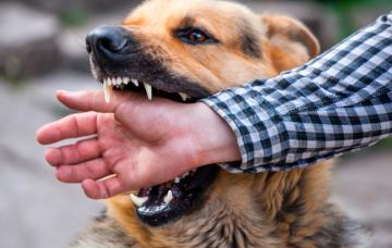 Mordedura de perro en la mano