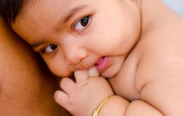 Niño con poliomelitis