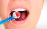 Consecuencias de una enfermedad periodontal