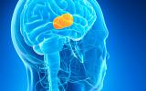 Complicaciones de los tumores cerebrales