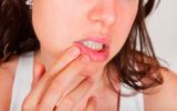 Una mujer se toca el labio en la zona donde va a salir un herpes