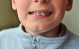 Niño con ortodoncia