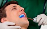 Precauciones en el blanqueamiento dental