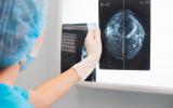 Resultados de una mamografía