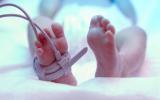 Tratamiento de la ictericia del recién nacido