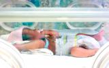 Tratamiento del síndrome Patau en incubadora