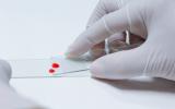 Nueva técnica que detecta el VIH con dos gotas de sangre seca