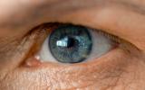 Retina del ojo de una persona con alzhéimer
