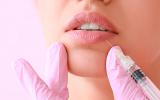 Tratamiento labios con ácido hialurónico