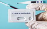 Sanidad planea realizar más test de diagnóstico del COVID-19