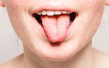 Los sarpullidos en la boca podrían ser un nuevo síntoma del coronavirus