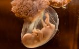 Plaxavid analizará el tejido placentario de embarazadas con coronavirus