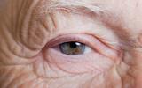 La vitamina B₃, útil contra el glaucoma