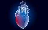 Corazón con endocarditis infecciosa