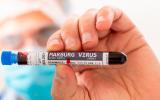 Virus Marburg: primer caso en Guinea
