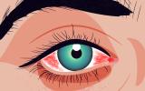 Síndrome de ojo seco