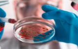 Científico trabaja con platos de Petri con muestras de sangre.