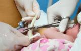 Medicos cortando el cordón umbilical entre un recién nacido y la placenta