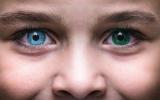 Heterocromía: tener cada ojo de un color