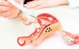 Ginecólogo que muestra la estructura uterina en un modelo 3D