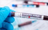 Virus de Marburgo: test positivo