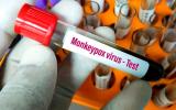 Test del virus monkeypox