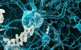 Neuronas con placas amiloides