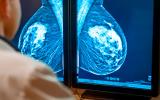 Médico analizando una mamografía
