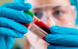Análisis en el laboratorio de una muestra de sangre