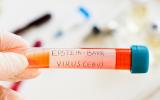 Técnico laboratorio sujeta tubo con etiqueta virus Epstein-Barr