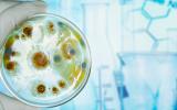 Estudio de la microbiota en una placa de Petri