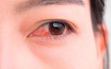 Alergias en ojos y oídos
