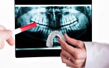 Un dentista sujeta una férula de descarga frente a una radiografía