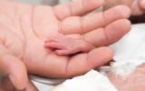 Un adulto sostiene la manita de un bebé prematuro