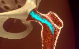 Adipocitos de la médula ósea