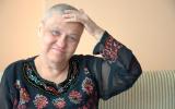 Mujer mayor en tratamiento con quimioterapia