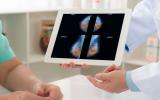 Radiografía que visualiza un posible cáncer de mama