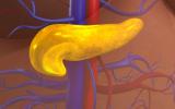 Ilustración 3D cáncer de páncreas