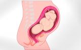 El cuello uterino ayuda a predecir un parto prematuro